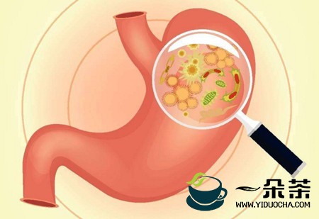 茶垢可能会引发霉菌性肠炎、霉菌性胃炎等疾病